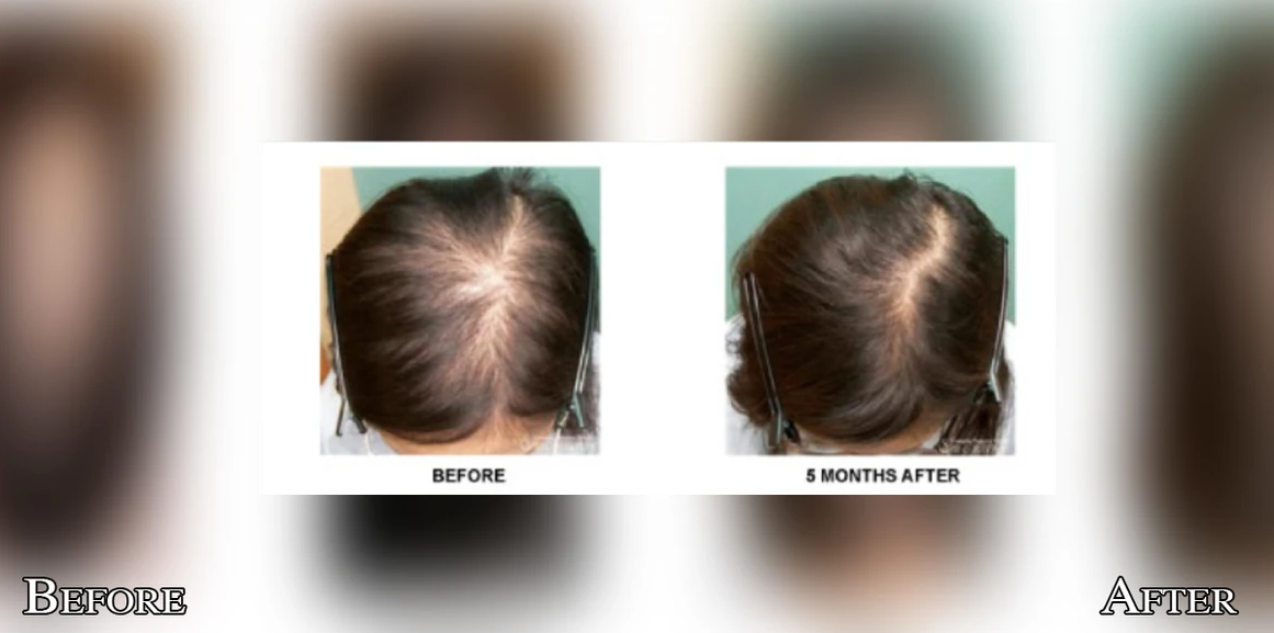 Hair 1 Screenshot 2024-01-27 033801