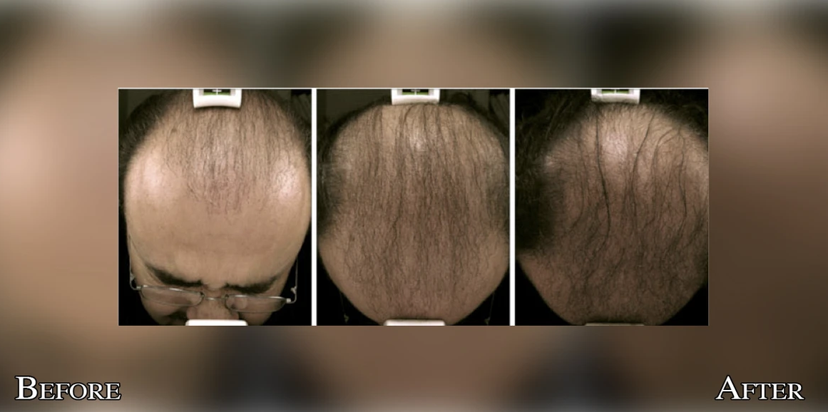 Hair 2 Screenshot 2024-01-27 033815