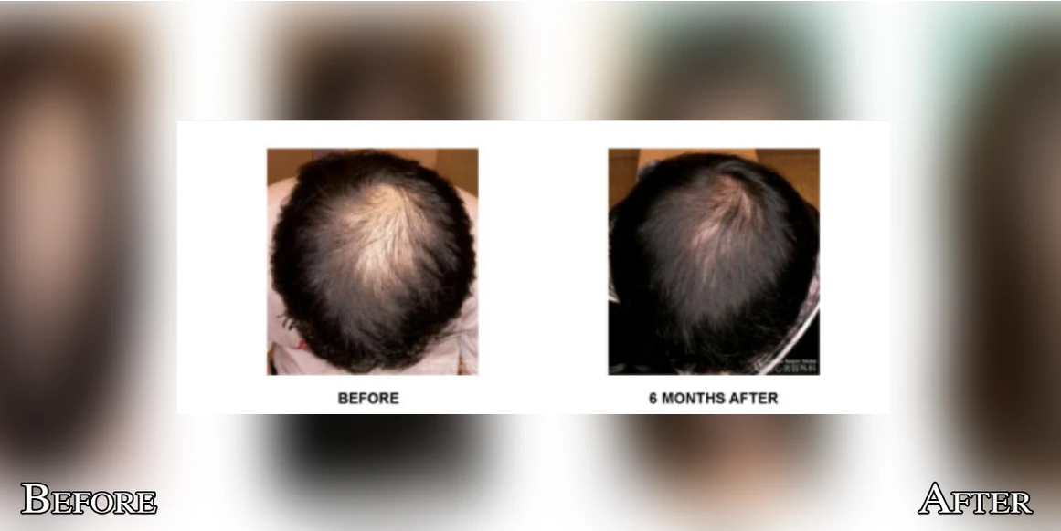 Hair 5 Screenshot 2024-01-27 033920