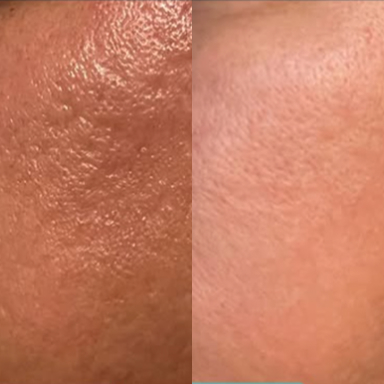 before after 2 before after 2