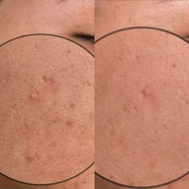 before after 3 before after 3