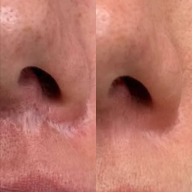 before after 4 before after 4
