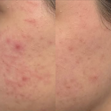 before after 5 before after 5