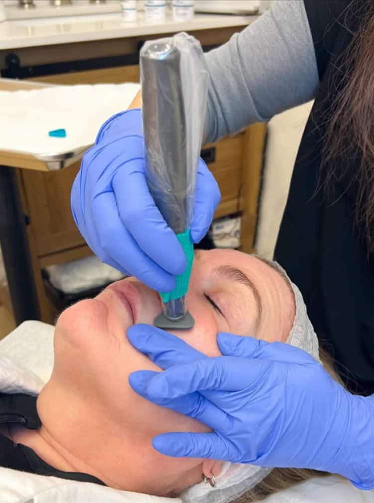 facial treatment with a cosmetic device handled by a professional wearing blue gloves facial treatment with a cosmetic device handled by a professional wearing blue gloves